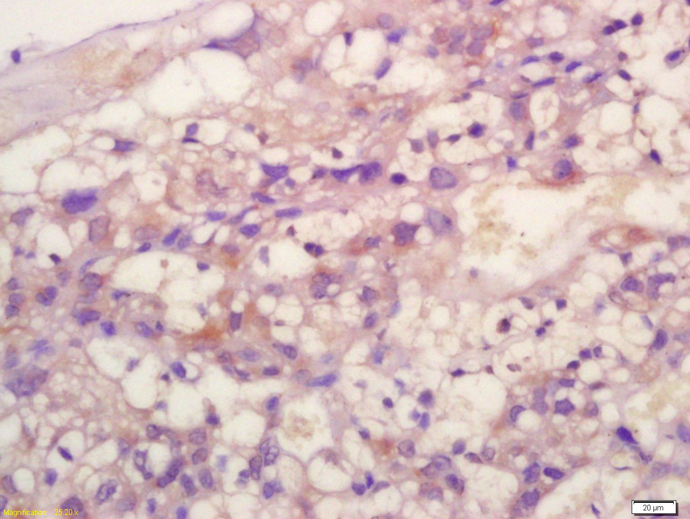 Anti-TIMP-2 Polyclonal Antibody