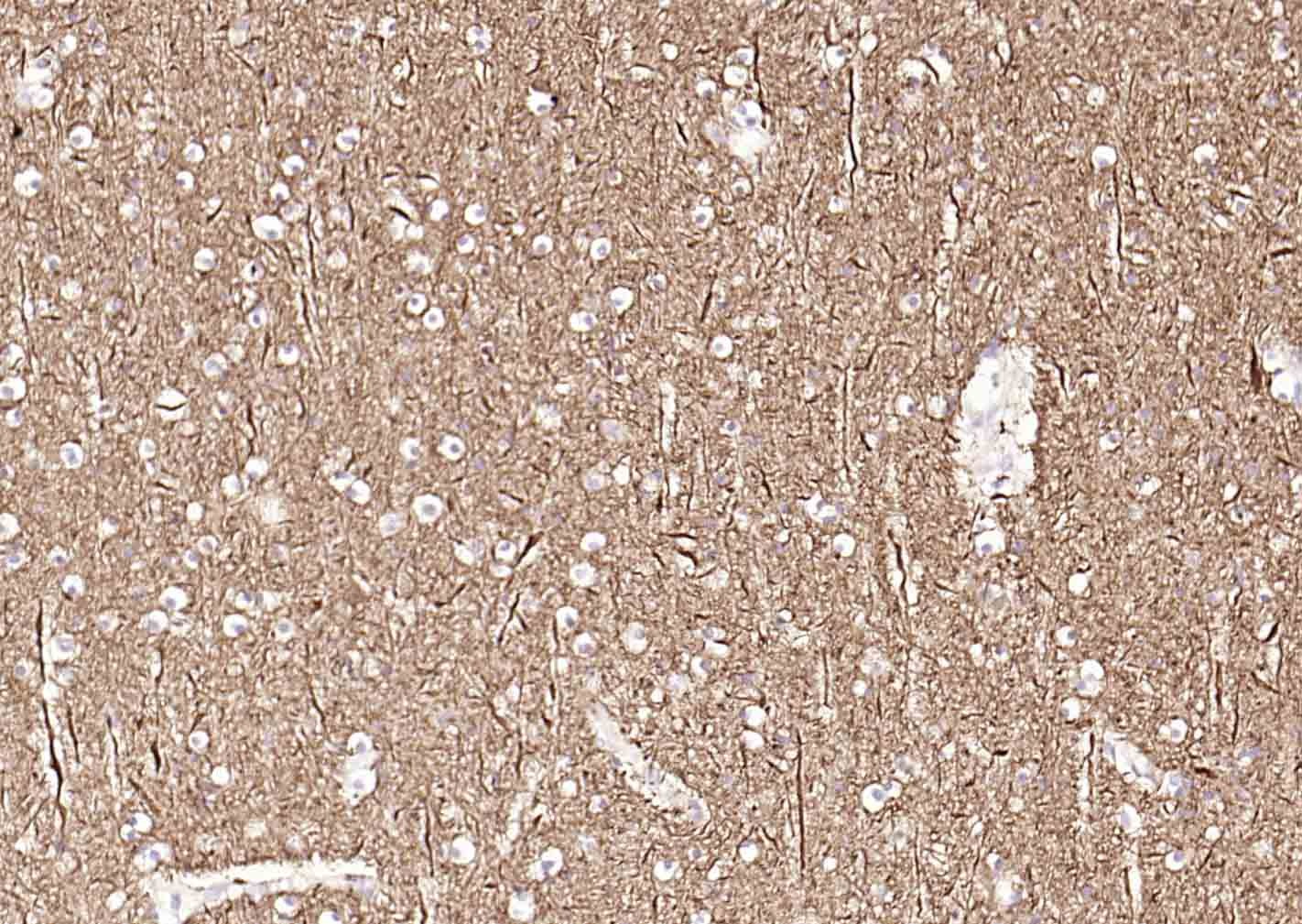 Anti-TUBB3 Antibody (1C239)