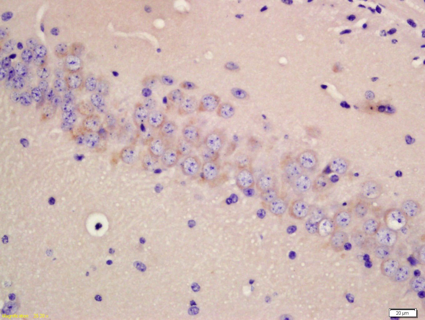 Anti-TPH2 Polyclonal Antibody
