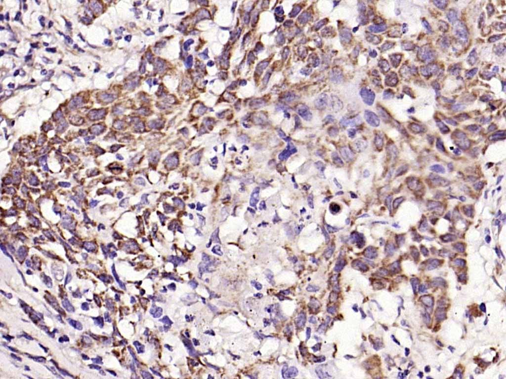 Anti-TIMP-1 Polyclonal Antibody 2
