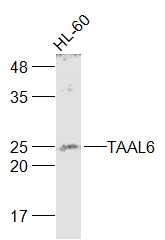 Anti-TM4SF1 Polyclonal Antibody