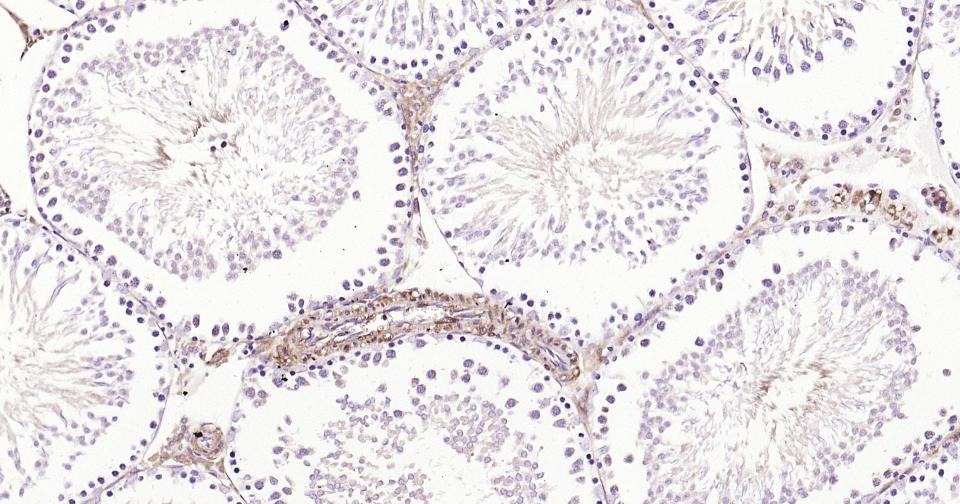 Anti-Thrombin Receptor Polyclonal Antibody