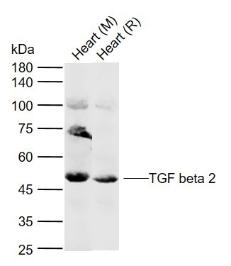 Anti-TGF beta 2 Polyclonal Antibody