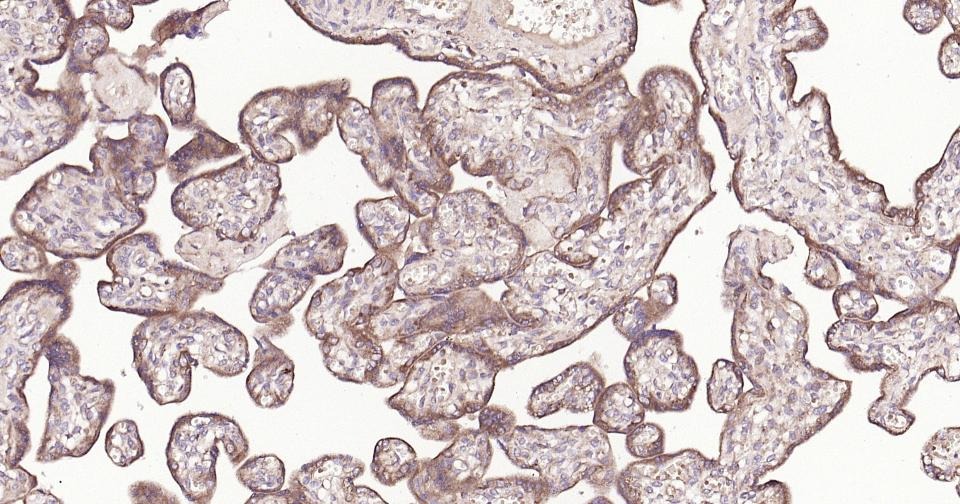 Anti-Thrombin Receptor Polyclonal Antibody