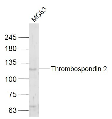 Anti-Thrombospondin-2/THBS2 Polyclonal Antibody