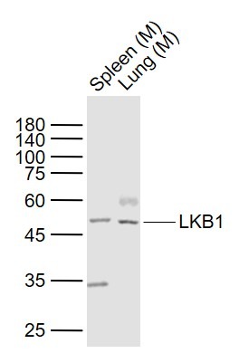 Anti-STK11 Polyclonal Antibody