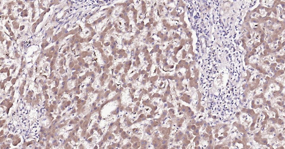 Anti-Thrombin Receptor Polyclonal Antibody