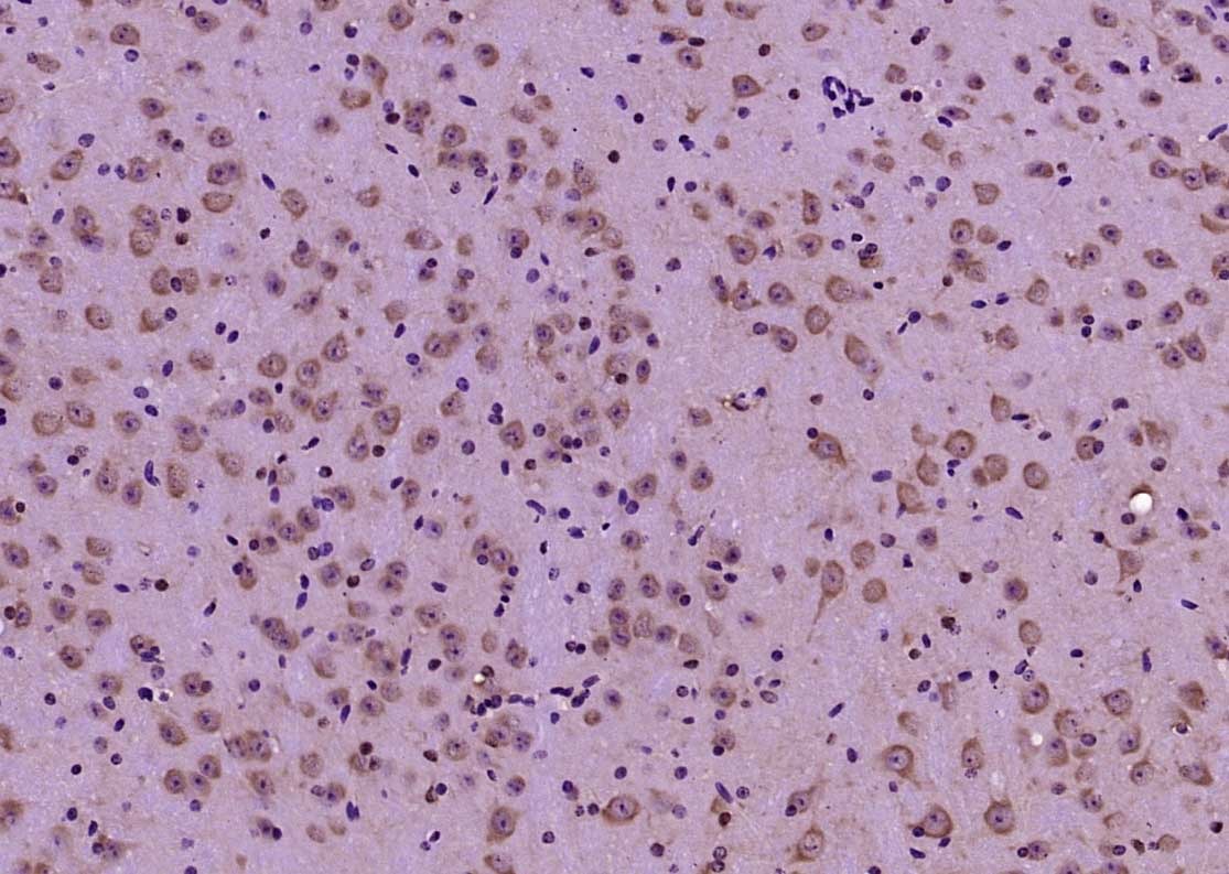 Anti-STK11 Polyclonal Antibody