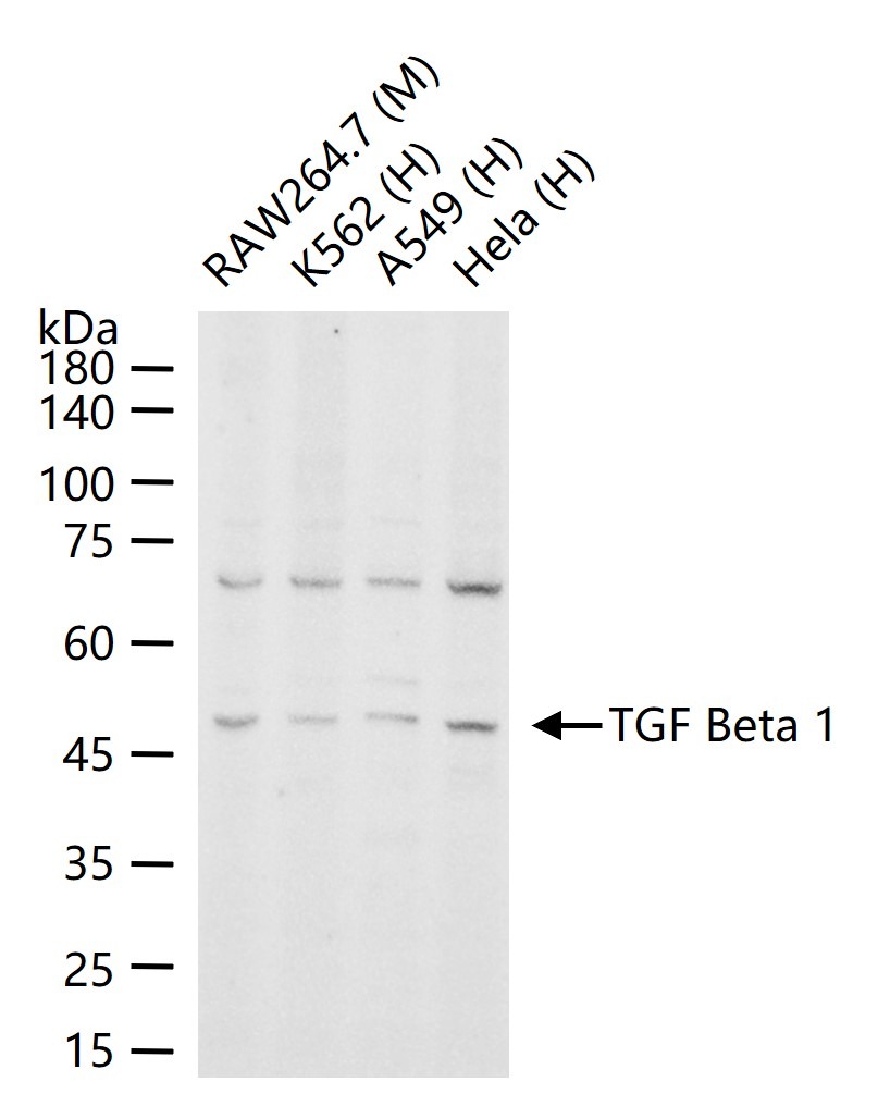 Anti-TGF beta 1 Polyclonal Antibody