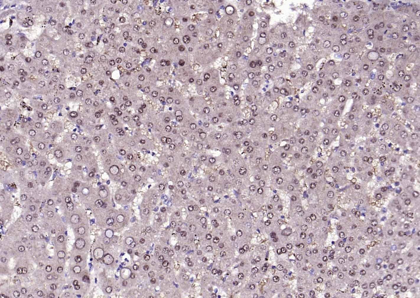 Anti-STK11 Polyclonal Antibody