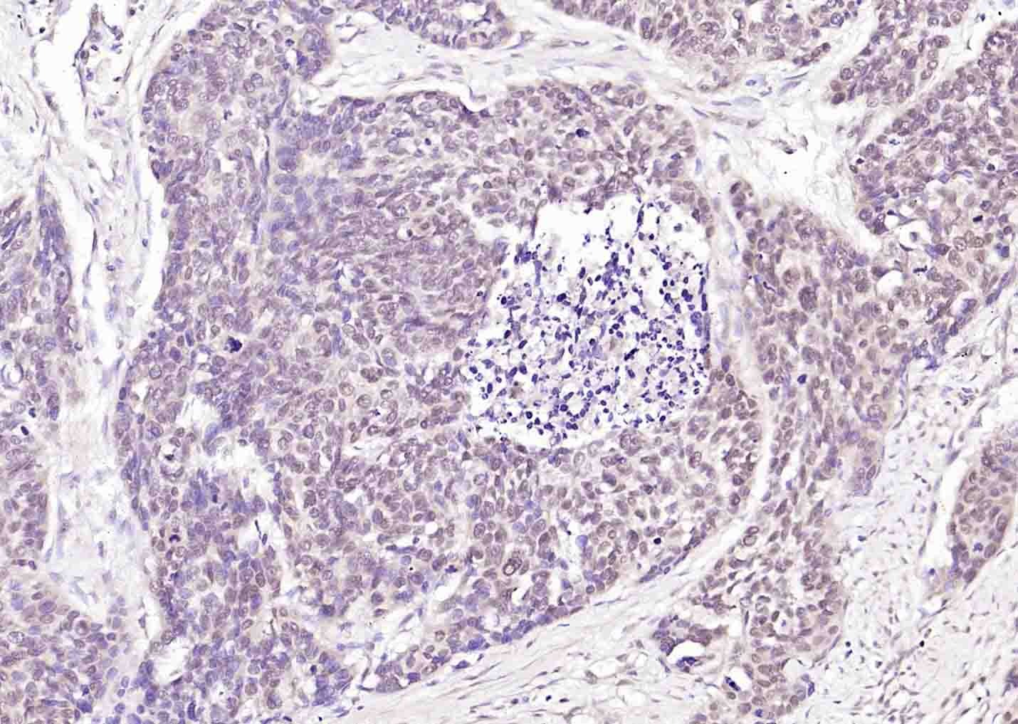 Anti-STK11 Polyclonal Antibody