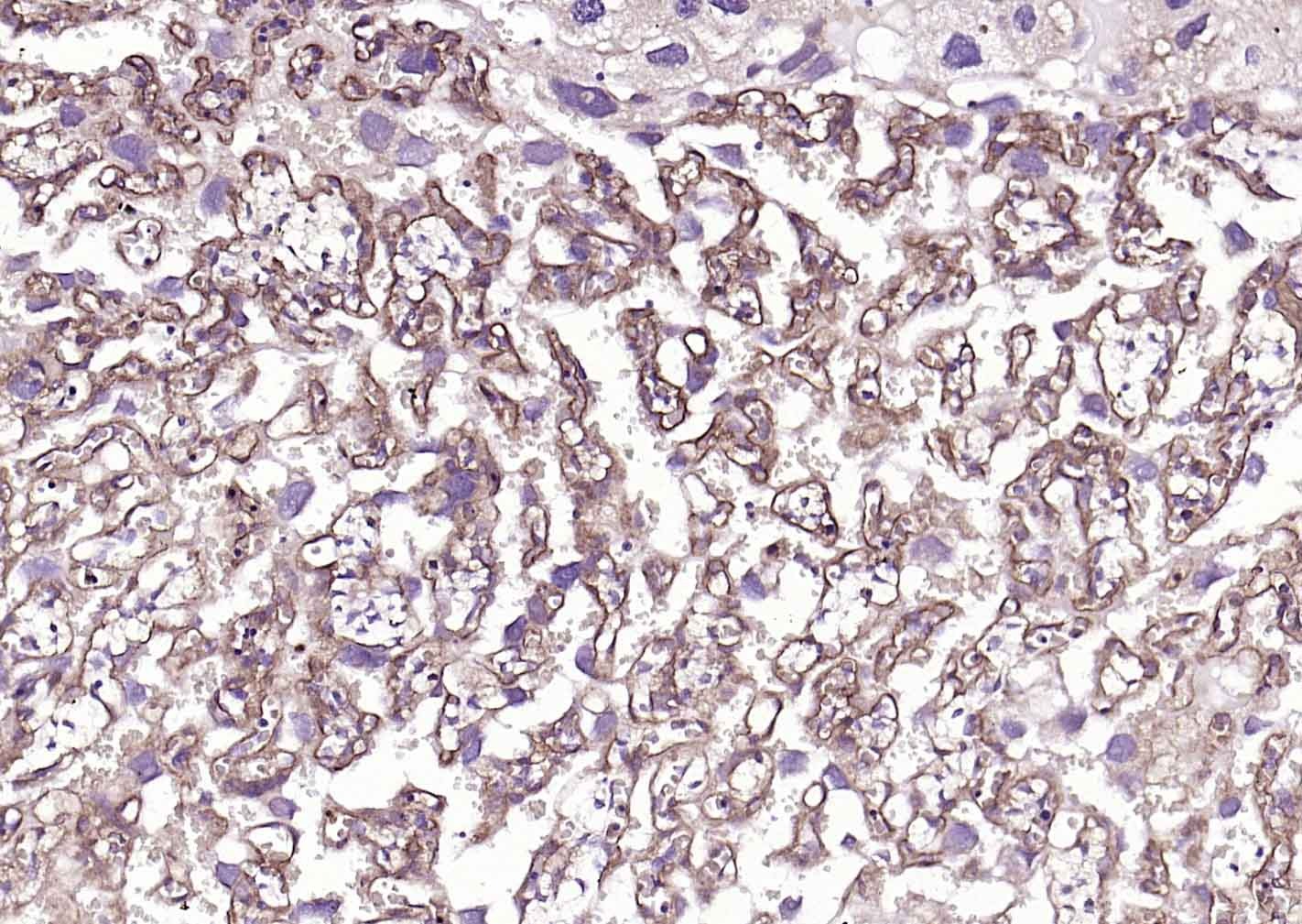 Anti-TGFBR2 Polyclonal Antibody