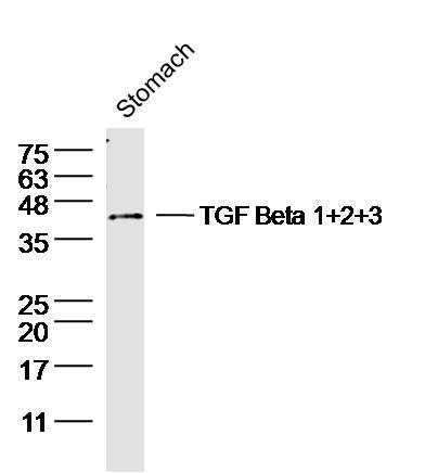 Anti-TGF beta 1/2/3 Polyclonal Antibody