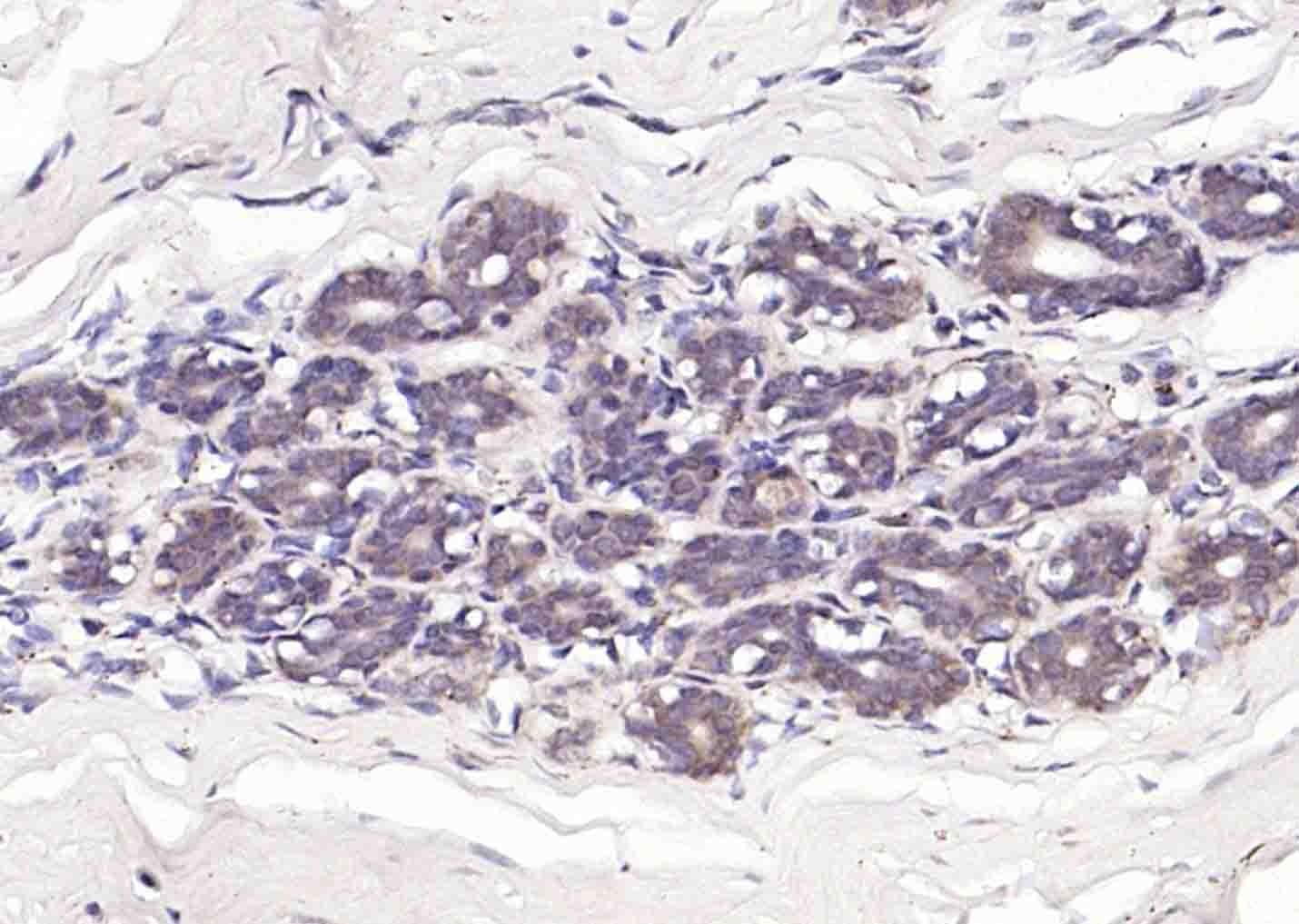 Anti-STK11 Polyclonal Antibody