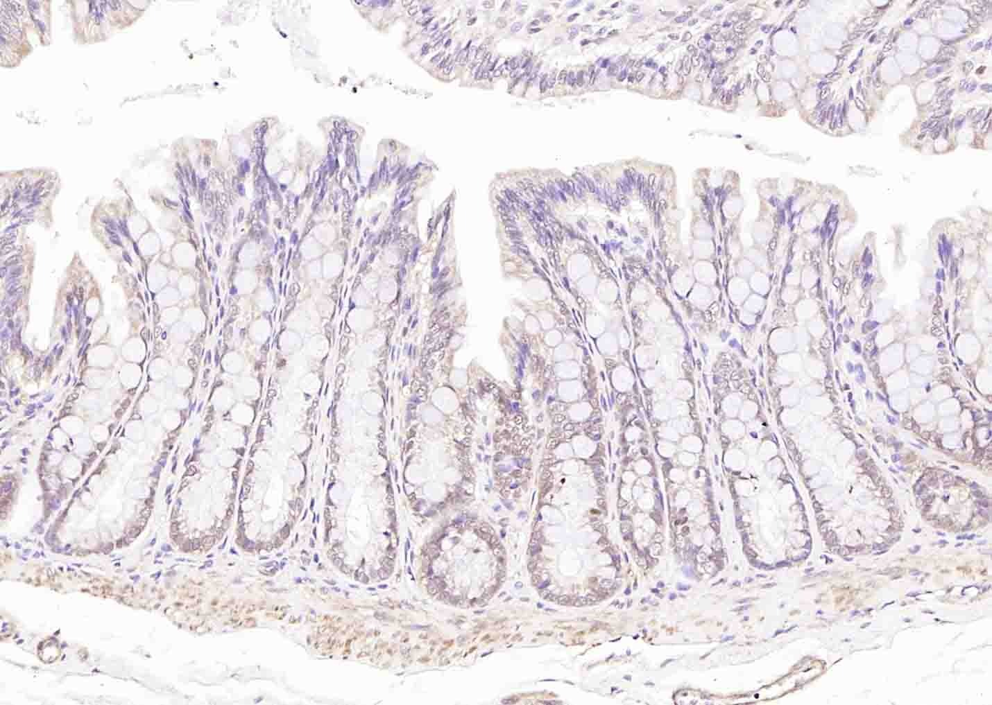Anti-STK11 Polyclonal Antibody