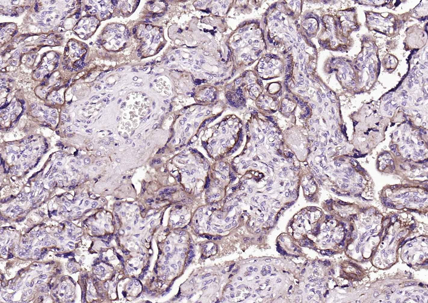 Anti-TGFBR2 Polyclonal Antibody