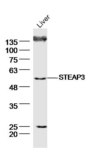 Anti-STEAP3 Polyclonal Antibody