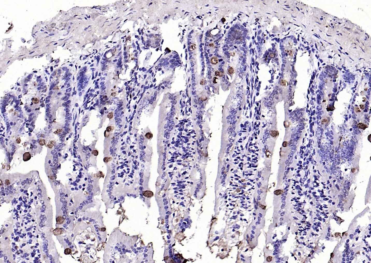 Anti-TFF3 Polyclonal Antibody