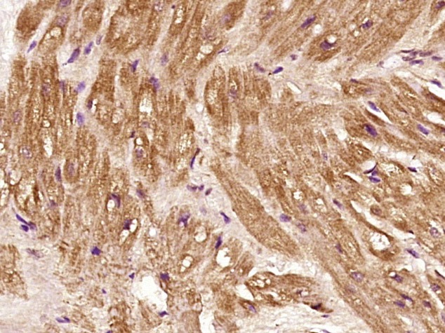 Anti-THBS1 Polyclonal Antibody