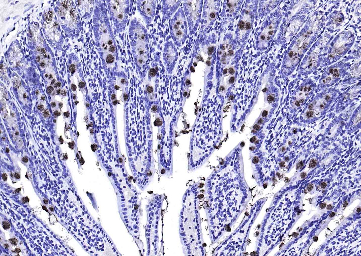 Anti-TFF3 Polyclonal Antibody