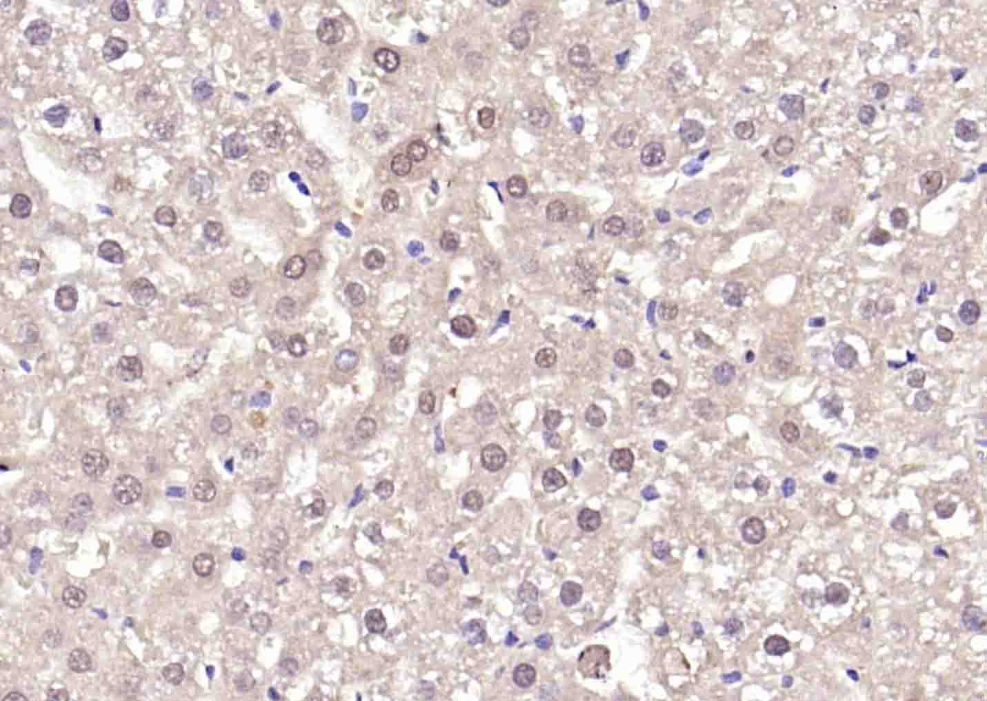 Anti-STK11 Polyclonal Antibody