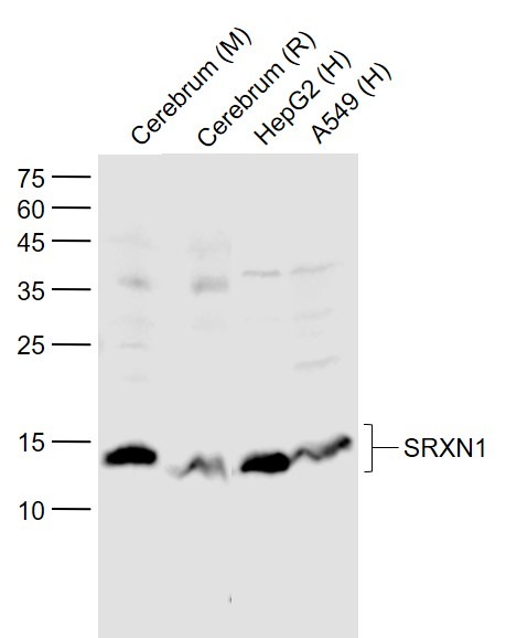 Anti-Sulfiredoxin-1 Polyclonal Antibody