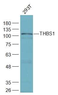 Anti-THBS1 Polyclonal Antibody