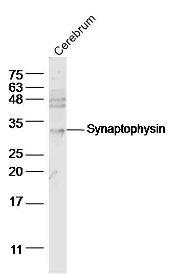 Anti-Synaptophysin/SYP Polyclonal Antibody