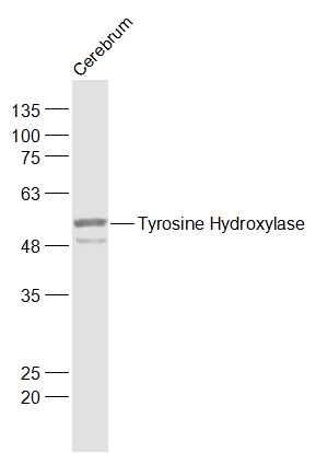 Anti-Tyrosine Hydroxylase Polyclonal Antibody 2