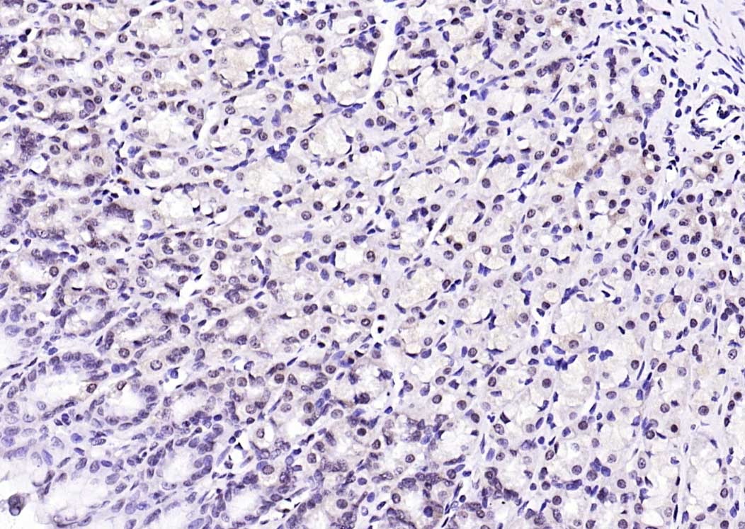 Anti-Ubiquitin Antibody (5H931)