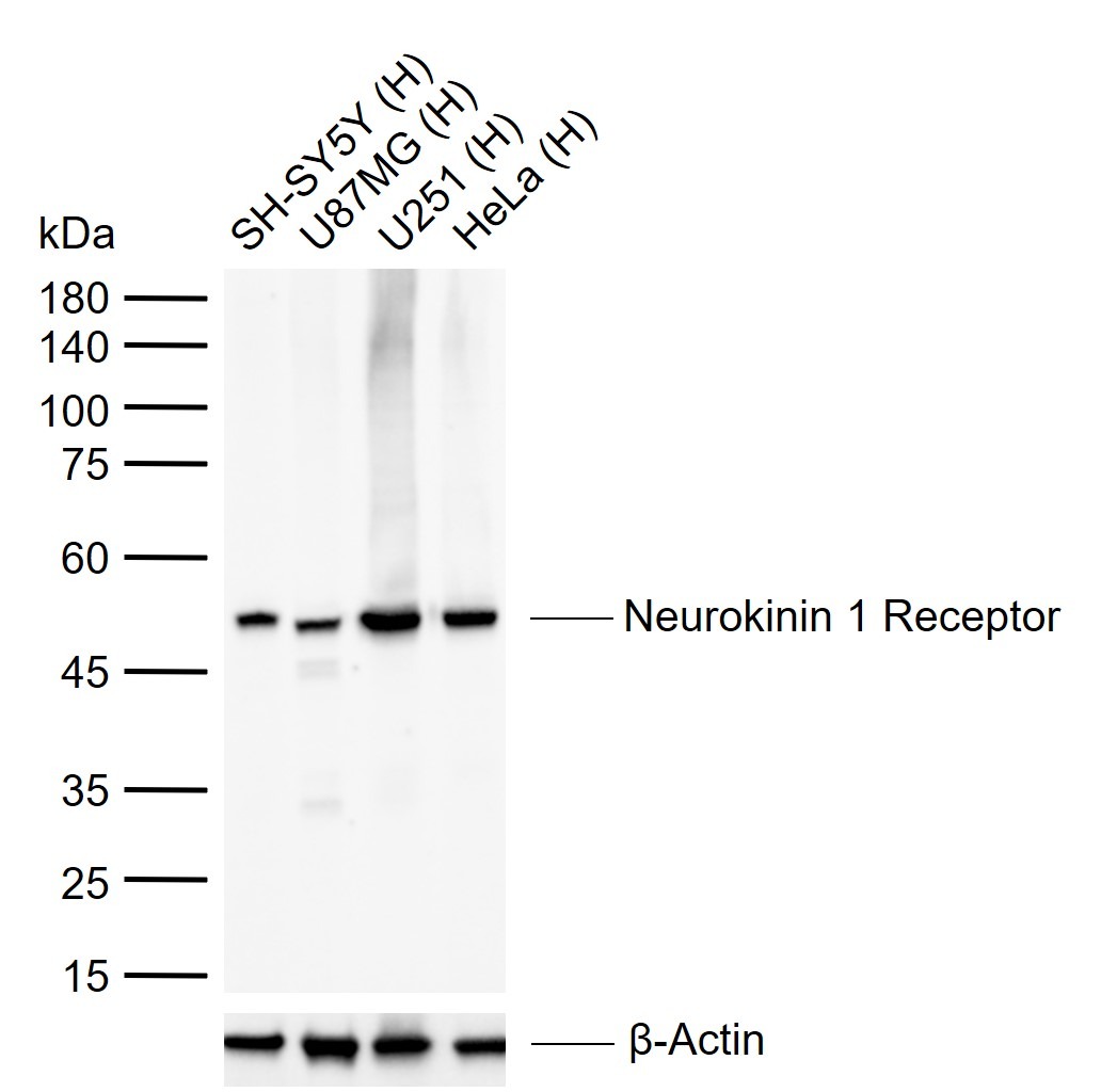 Anti-TACR1 Polyclonal Antibody