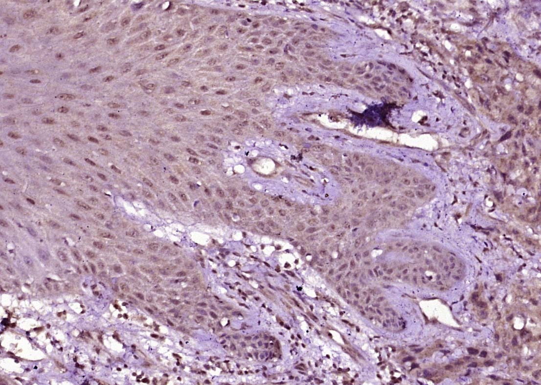 Anti-Ubiquitin Polyclonal Antibody