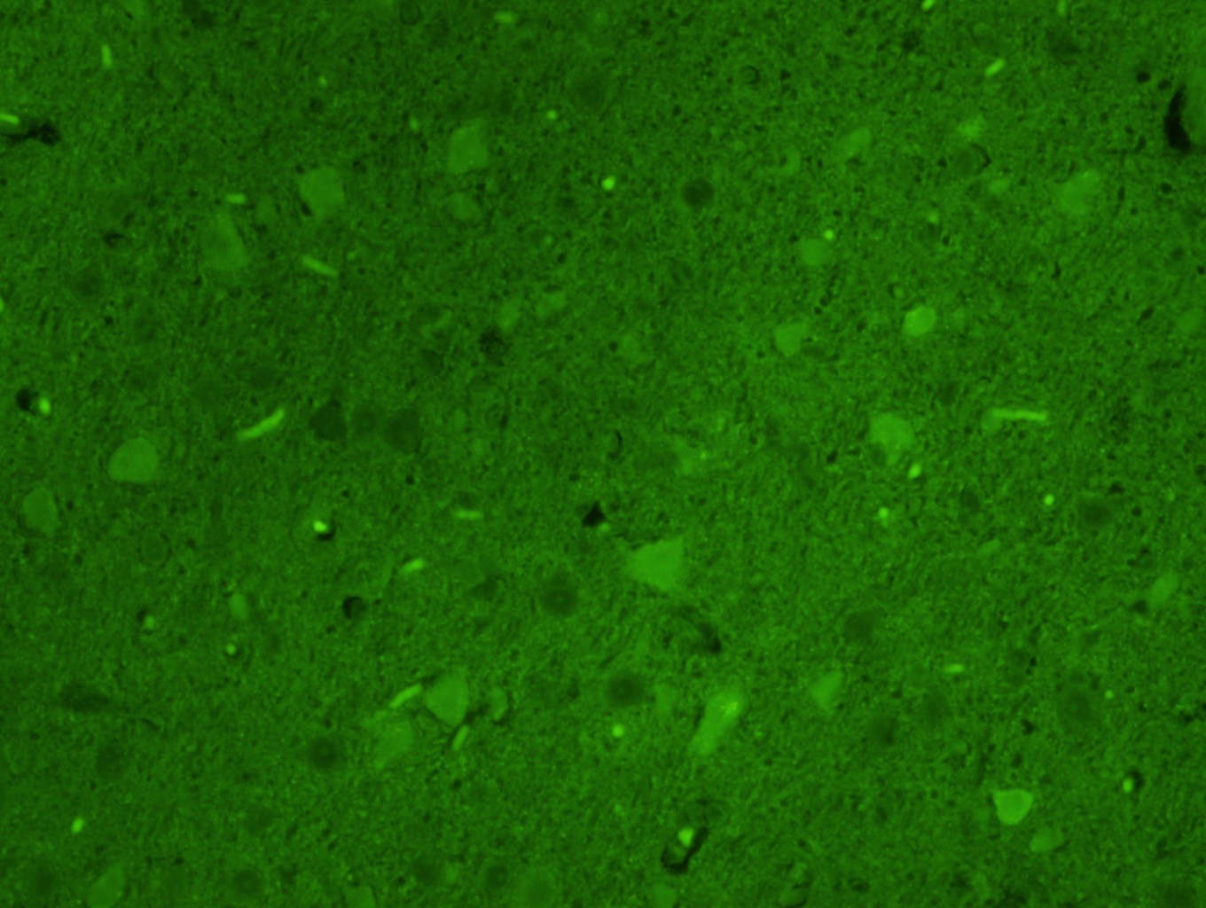 Anti-Tyrosine Hydroxylase Polyclonal Antibody