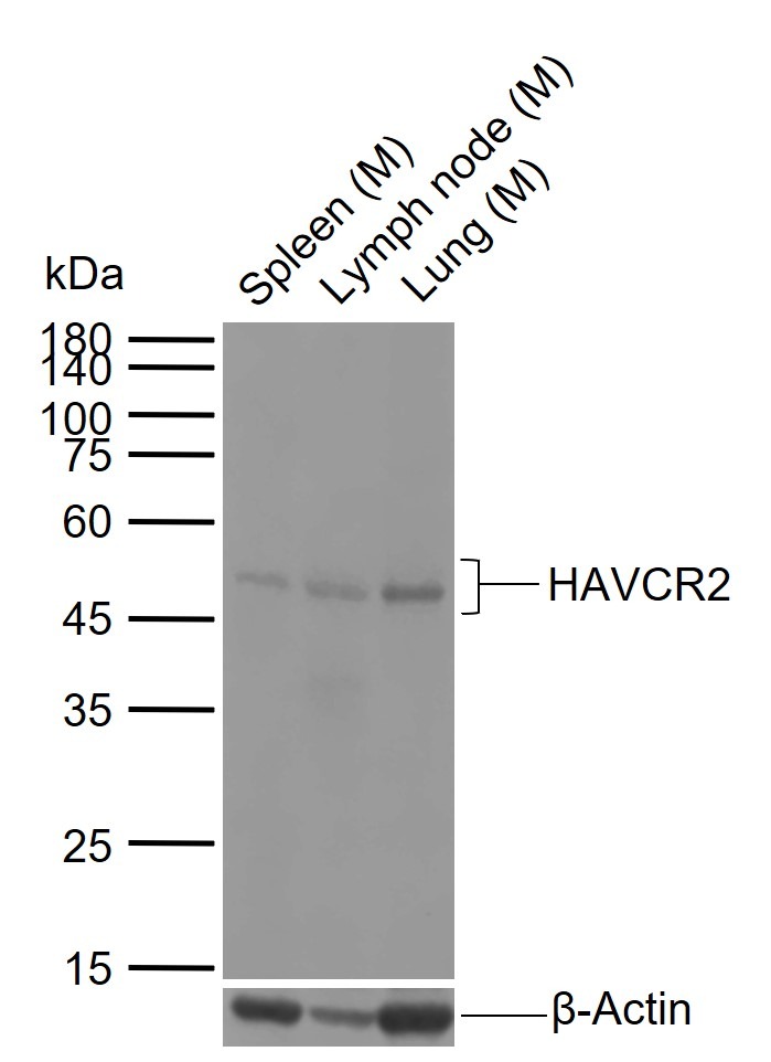 Anti-TIM-3/KIM-3/HAVCR2 Polyclonal Antibody 2