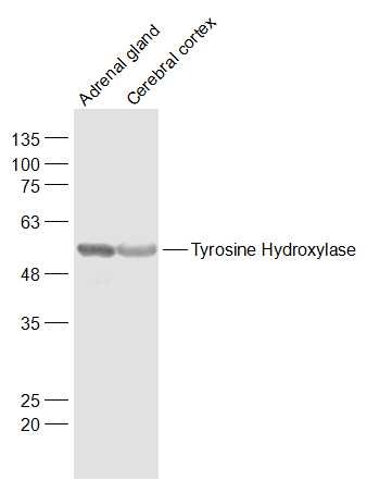 Anti-Tyrosine Hydroxylase Polyclonal Antibody 2