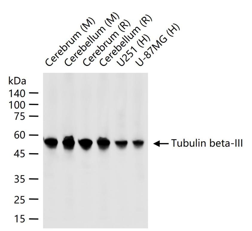 Anti-TUBB3 Antibody (3P633)