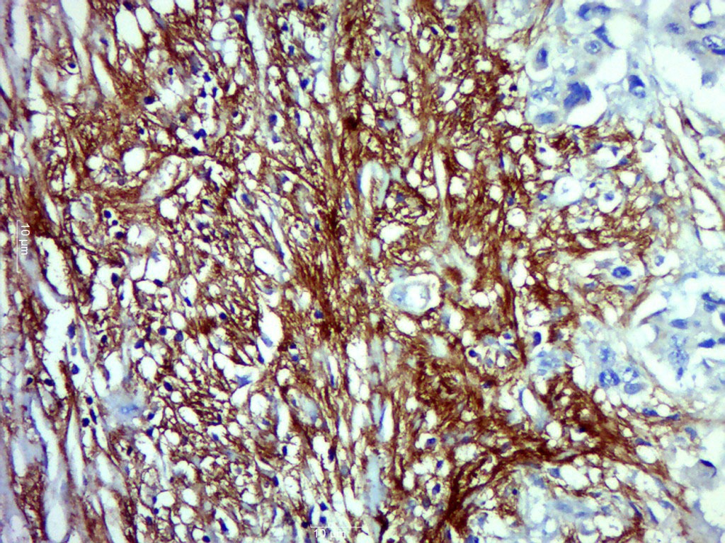 Anti-Syndecan-1 Polyclonal Antibody