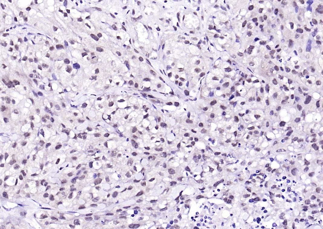 Anti-Ubiquitin Antibody (5H931)
