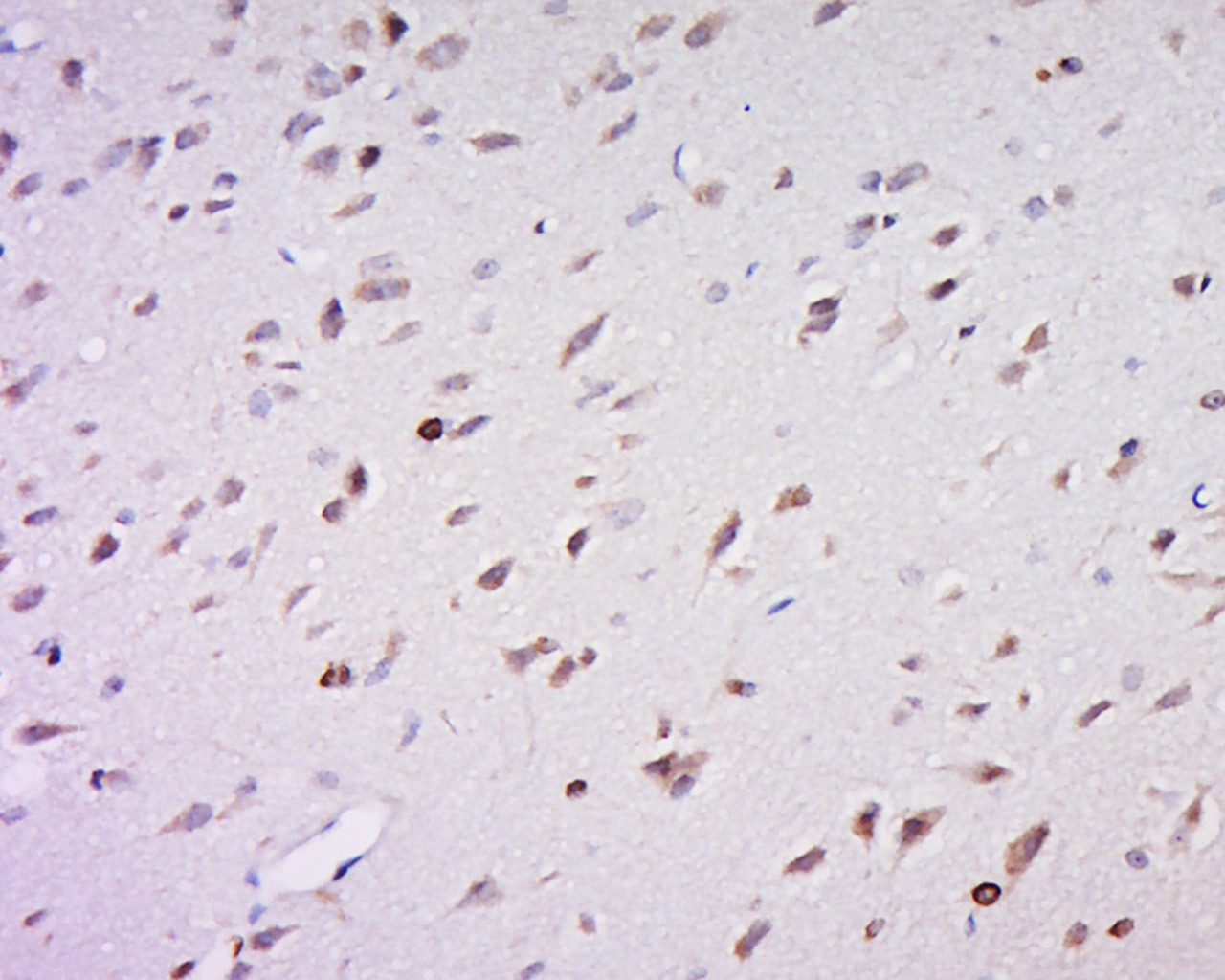 Anti-Tyrosinase/TYR Polyclonal Antibody