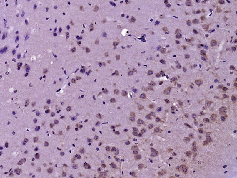 Anti-Tyrosine Hydroxylase Polyclonal Antibody