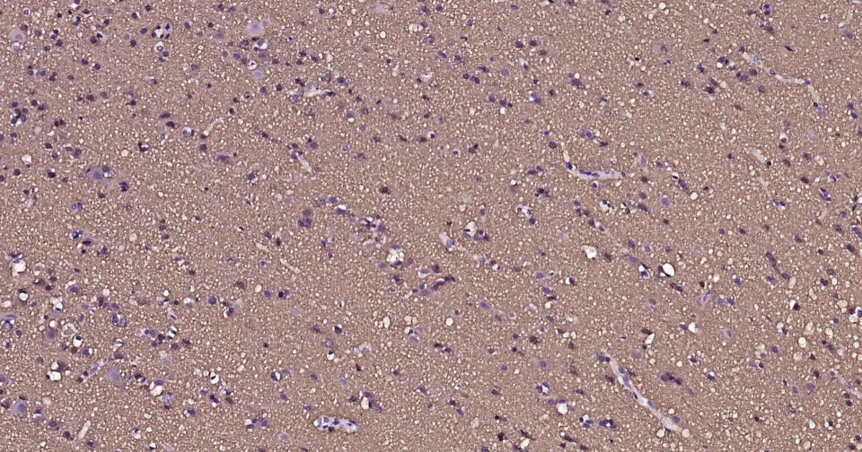 Anti-TUBB3 Antibody (3P633)