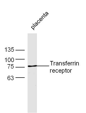 Anti-Transferrin Receptor/TFRC Polyclonal Antibody