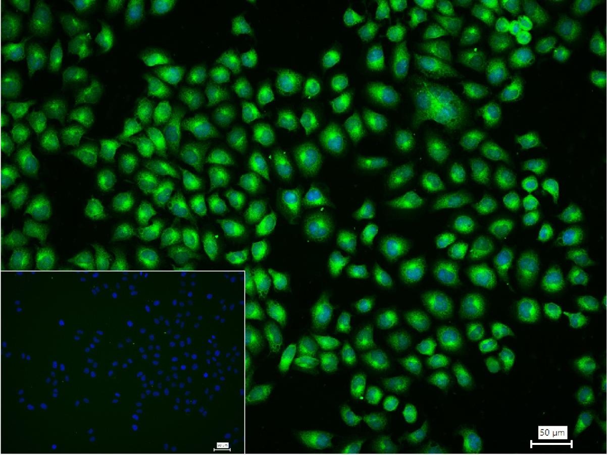 Anti-Transferrin Receptor/TFRC Antibody (4F227)