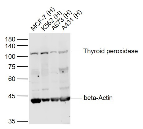 Anti-Thyroid peroxidase Polyclonal Antibody