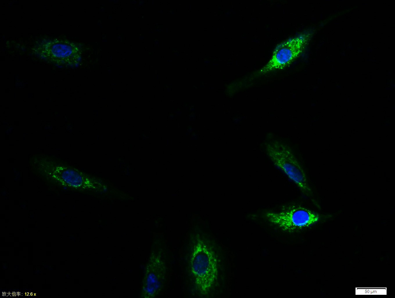 Anti-TIE2 Polyclonal Antibody