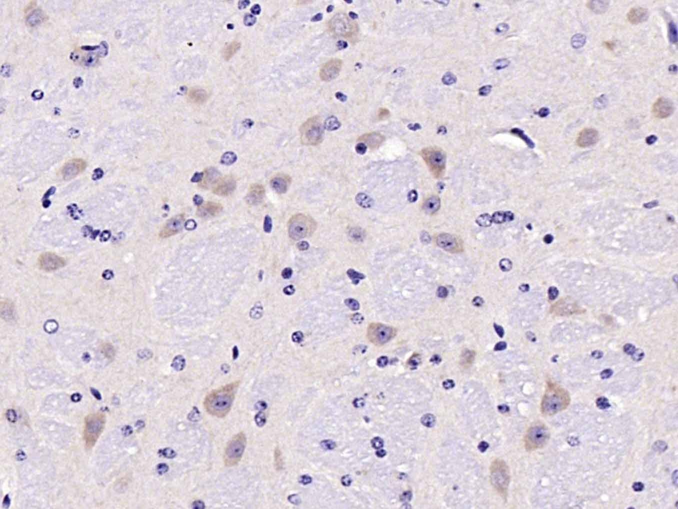 Anti-Tyrosine Hydroxylase Polyclonal Antibody