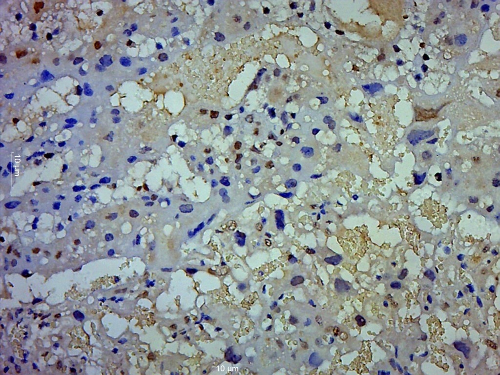 Anti-TWIST Polyclonal Antibody