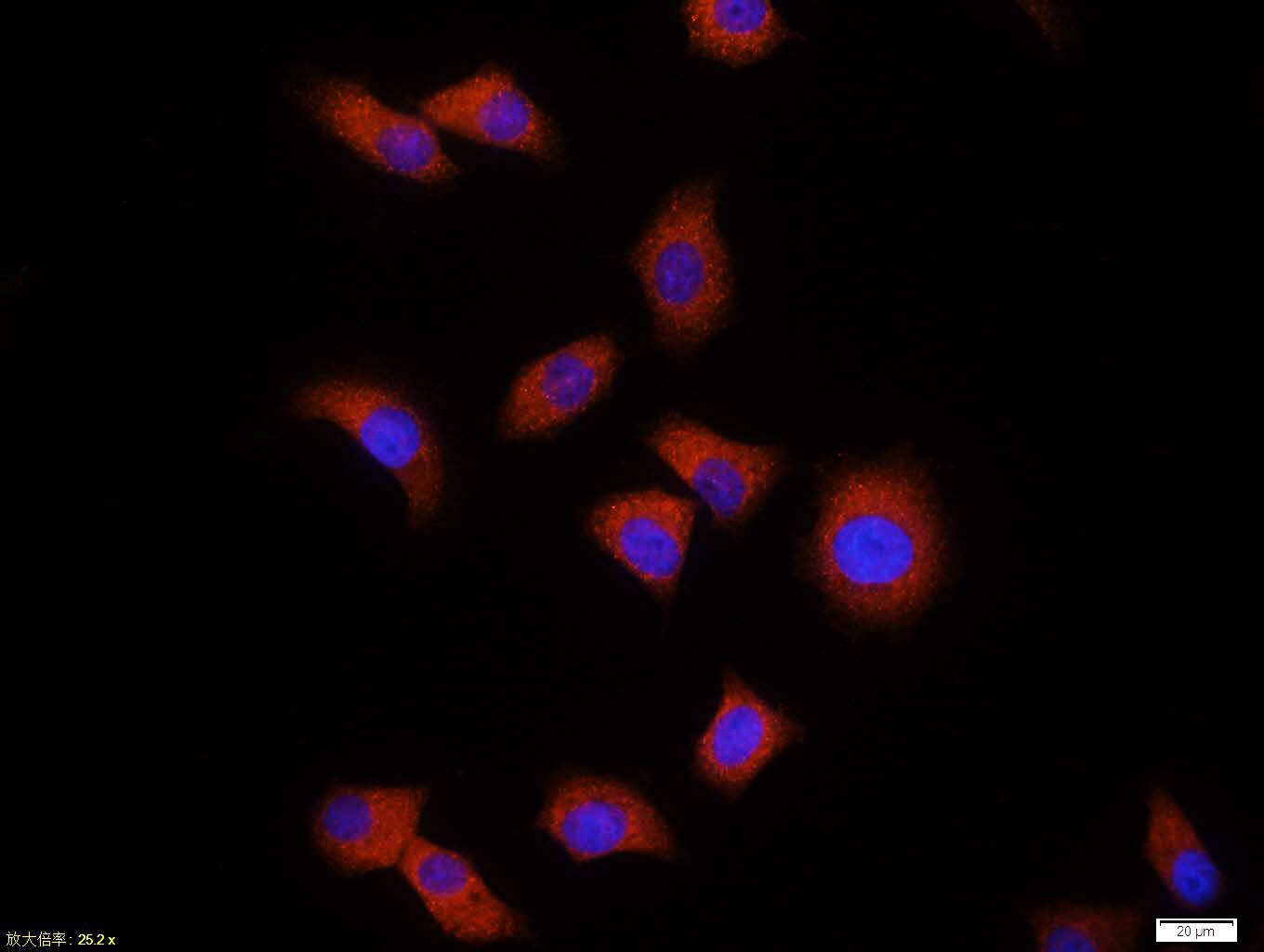 Anti-Ubiquitin Antibody (5H931)