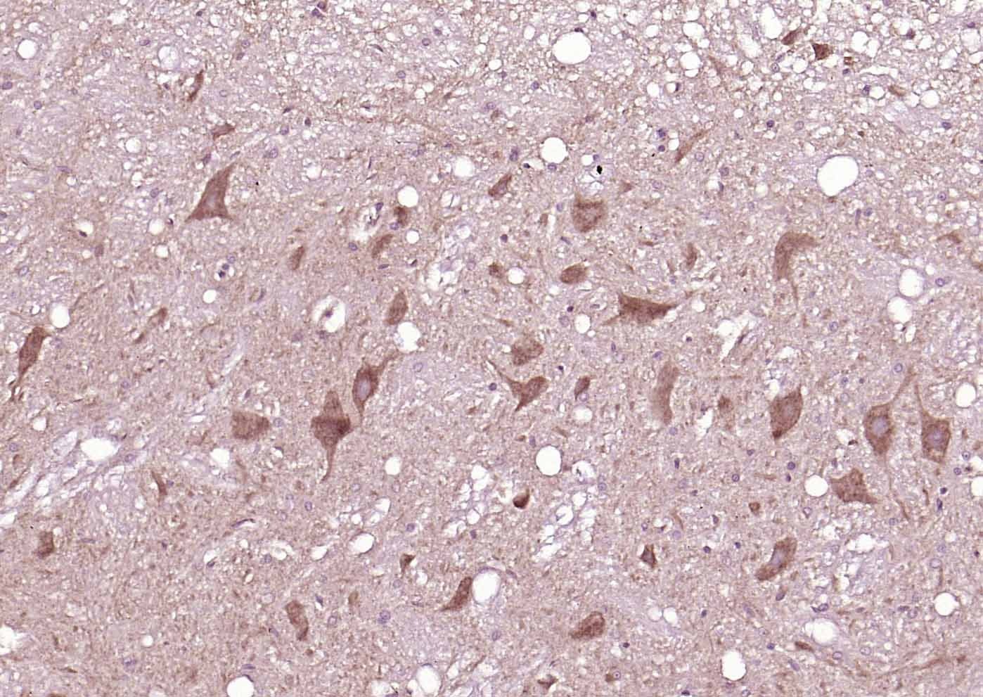 Anti-Synapsin-1 Polyclonal Antibody