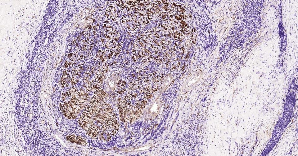 Anti-TUBB3 Antibody (3P633)
